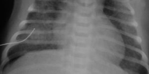 radiografias en ninos y adultos
