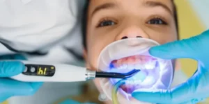 selladores dentales previenen caries infantiles