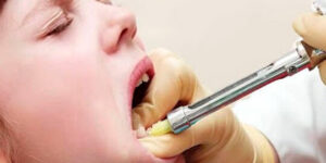 tecnicas de anestesia en endodoncia pediatrica
