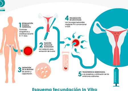 tecnicas de fiv en parejas del mismo sexo