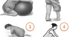 tecnicas para mitigar dolor en parto
