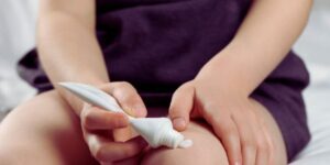 tratamientos efectivos para la psoriasis infantil