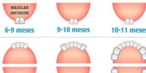 etapas de la denticion en bebes