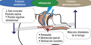 factores que afectan el sueno en ninos