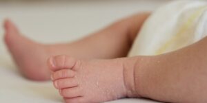 piel seca en ninos consejos utiles