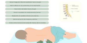 riesgos y beneficios de anestesia