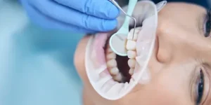 tratamiento ortodoncico en dientes de leche