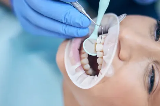 tratamiento ortodoncico en dientes de leche