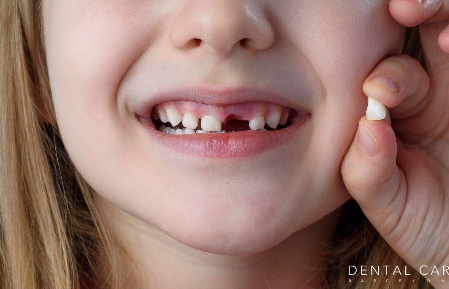 extraccion de dientes de leche