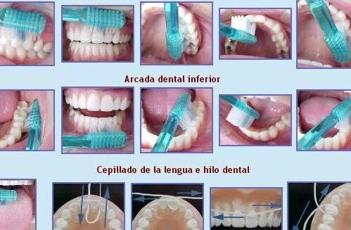 tecnicas de cepillado para ninos