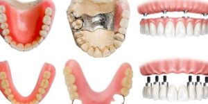 tratamientos de rehabilitacion oral en odontopediatria