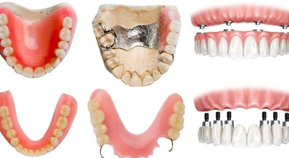 tratamientos de rehabilitacion oral en odontopediatria
