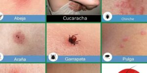 insectos causantes de picaduras y sintomas