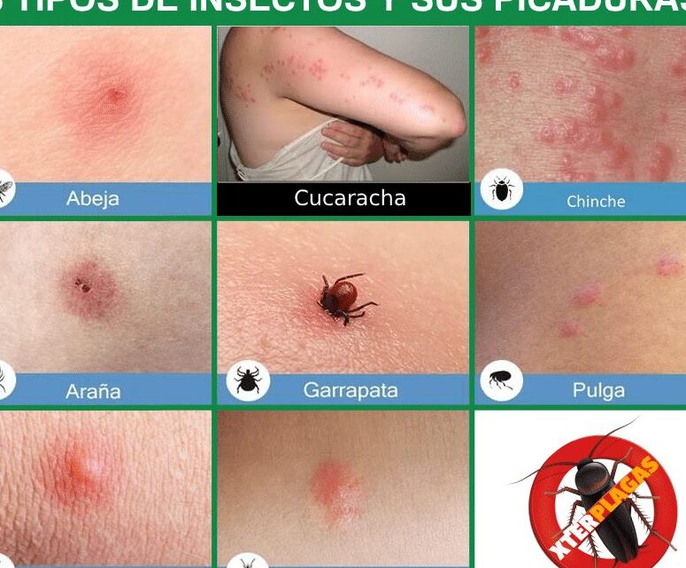 insectos causantes de picaduras y sintomas